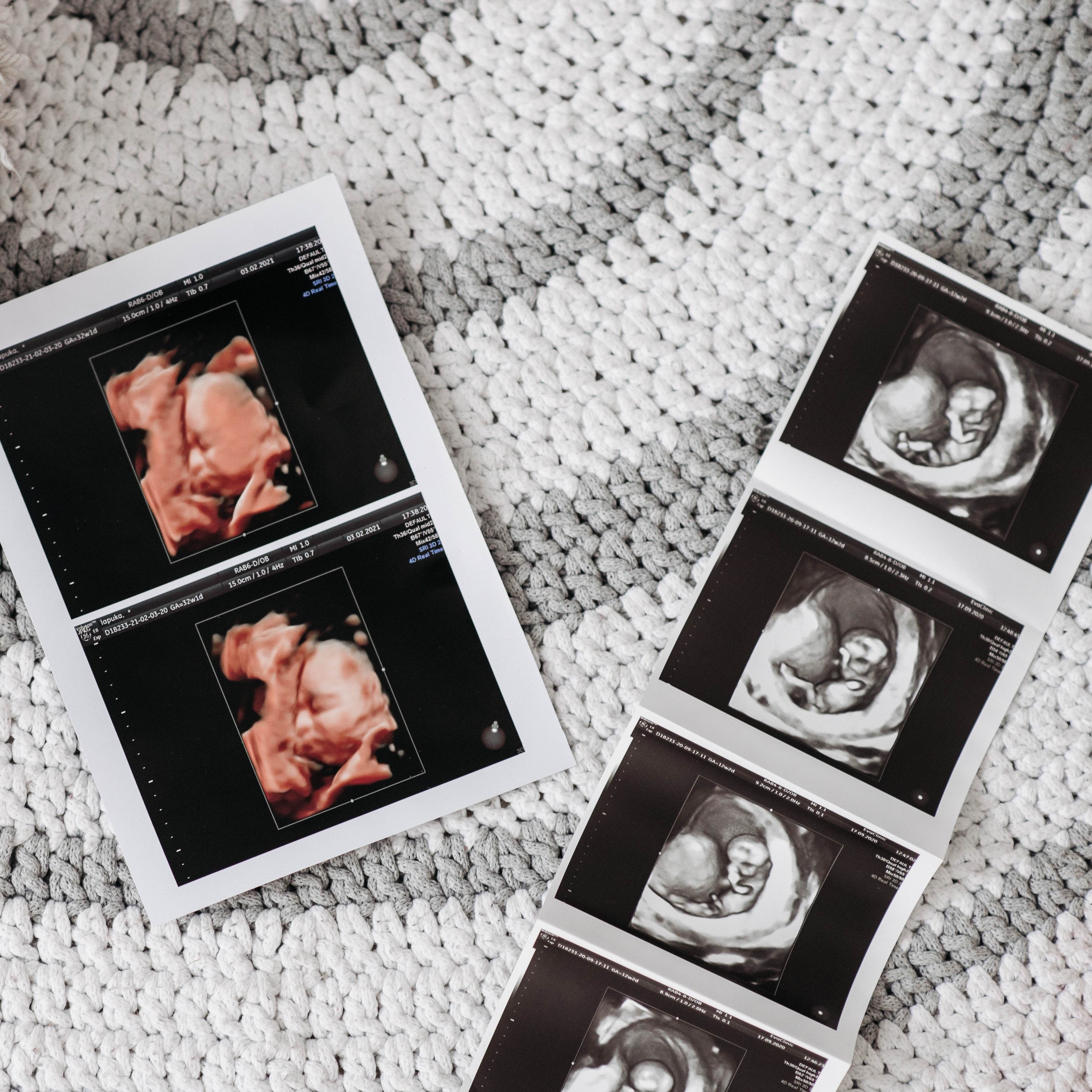 I'm pregnant, now what? - Kendamil EU